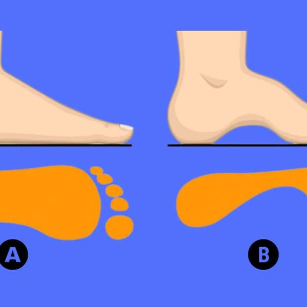 Personality Test: Discover your hidden traits by choosing from these foot arches!