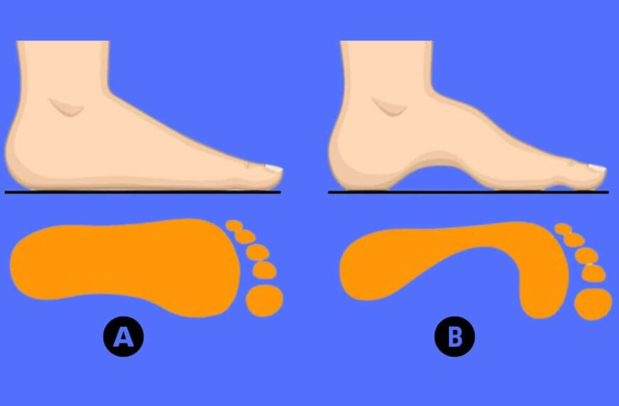 Personality Test: Discover your hidden traits by choosing from these foot arches!